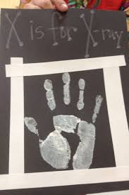 There's a massive gender gap. X Is For X Ray Handprint Preschool Letter Crafts Letter X Crafts Alphabet Activities Preschool