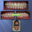 Complete Denture product image