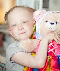 The signs and symptoms of cancer depend on the type of cancer, where it's located, how advanced it is, and how much it has spread. About Childhood Cancer Acco