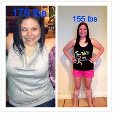 What A Smile When You Lose 20 Lbs Lose 15 Pounds Lose 20 Pounds Lose 20 Lbs