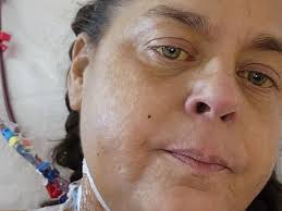 Fundraiser for Joanne Lalegian by Danielle Ward : Help Joann Fight for Her  Life After a Liver Transplant