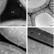 Check spelling or type a new query. Pdf Ultrastructure And Topochemistry Of Plant Cell Wall By Transmission Electron Microscopy