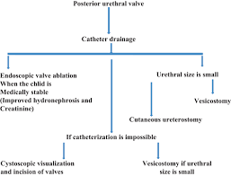 Posterior Urethral Valve Springerlink