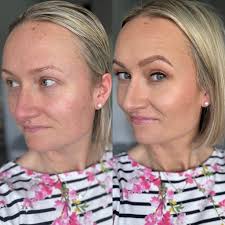 What are the best powders for dry skin?