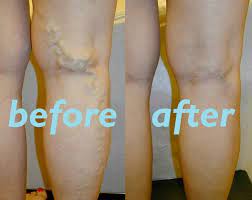 Pin On Natural Remedies And Healthy Lifestyle