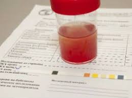 Dark Urine In Pregnant Medical Diagnosis