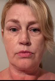 Hi friends. I'm praising Jesus because my ANA just came back negative, but  now I'm feeling more confused and conflicted. I have my explant scheduled  and some of my symptoms are severe