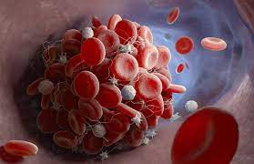 It was first identified in december 2019 in wuhan,. Paul Ehrlich Institut News Occurrence Of Cerebral Venous Thrombosis After Vaccination With Covid 19 Vaccine Astrazeneca