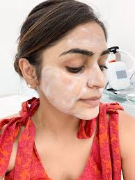 Clear & Brilliant Laser at Aura Dermatology