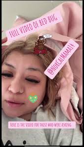 Bed Bugs in Night Vision