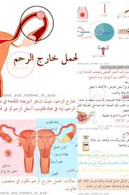 الحمل خارج الرحم Hcg Map Screenshot