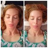 Image result for how much is a massage envy chemical peel