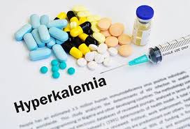 Hyperkalemia High Potassium Symptoms Treatment Causes Test