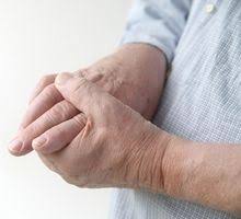 See more of association des maux des mains on facebook. Deformation Des Doigts Que Faire Est Ce Trop Tard