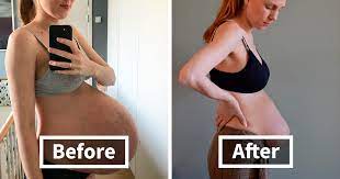 Woman Who Stunned The World With Her Huge Baby Belly Shows What Giving Birth To Triplets Does To Your Body Bored Panda