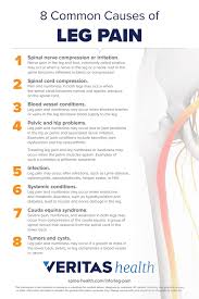 Image result for Leg Pain