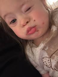 Has anyone's or their child who caught the flu had severe stomach pain with  it? Just pain, no bodily movements alongside the pain.