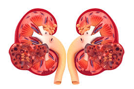 Renal vascular disease affects the blood flow into and out of the kidneys. Heart Disease And Kidney Disease Connection Vascular Health Clinics