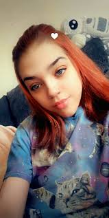 Any successful treatments for spinal stenosis and plexiform?