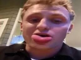 Man left with swollen tongue after bee hiding inside burger stings him