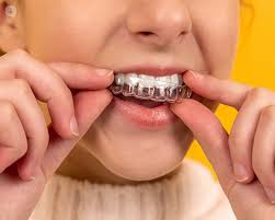 Maybe you would like to learn more about one of these? Bruxism How We Fix Teeth Grinding And Relieve Jaw Pain Top Doctors