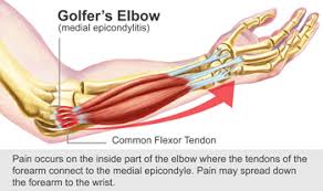 A lump on the forearm. Reduce Elbow Pain And Keep Golfing Arlington Pain And Rehab