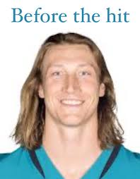 Colts Poor Performance After 0-2 Start