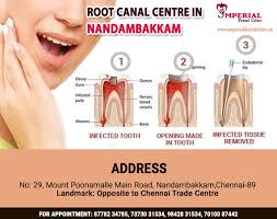 We did not find results for: Clean And Shape The Root By Getting Painless Root Canal Treatment Imperial Clinic By Vidhyanb Medium