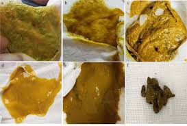 Image result for yellow stool human poop
