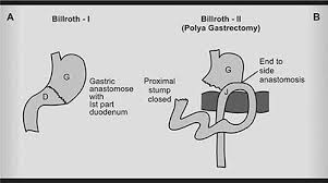 Image result for Succussion Splash