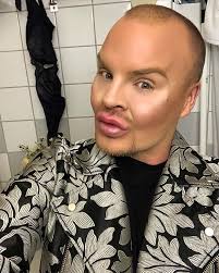 Svenske Robin är beroende av skönhetsingrepp: "Vill se ut som en  porslinsdocka"