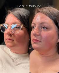 This glow-up came from a synergistic approach because true results don't  come from one thing, they come from the right things working together 💪🏼  🔹 ZO Skin Health Regimen → Reset skin