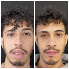 Consultório Dra. Denise Costa (@consultorio_dradenise) • Instagram photos  and videos