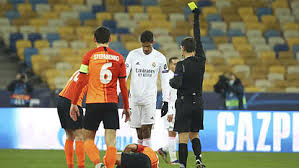 Real madrid were flat out 'embarrassing' vs. 2obpajzoglia8m