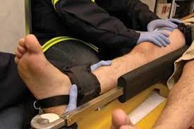 Image result for Femur Traction Splint