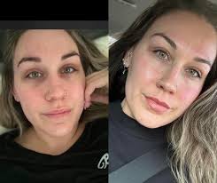 Girl, the biggest skincare is removing the man who stress you out.