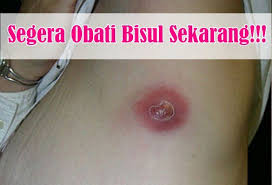 Privacy and terms of use. Ivermectin Ivermectin Japan Ivermectina Wikipedia Ivermectin Albendazole Oral Suspension Bandy Plus