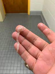 The brown discharge that sometimes you may notice after the ovulation is not even a matter to worry, but there are some reasons for having brown discharge. Weird Discharge Normal Pic Included October 2019 Babies Forums What To Expect