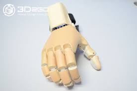A Closer Look The 3d Printed Prosthetic Hand For Grasping Objects Specifically Designed And Customized For Mela 3d Printing 3d Printing Projects Prosthetics