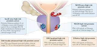 The express written permission of nccn. Surgical Management Of High Risk Localized Prostate Cancer Nature Reviews Urology