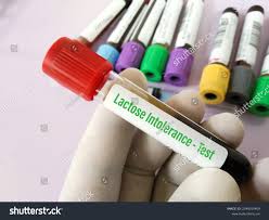 Image result for Lactose Tolerance Test