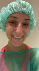 Intervento Rinoplastica a Bari con Prof. Michele Roberto