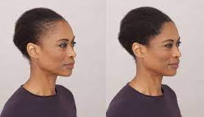 Hair loss prevention and treatment these colored sprinkles have special properties that help them attach to hair and give a fuller appearance. How Long Do Hair Fibers Last On Hair Toppik Blog