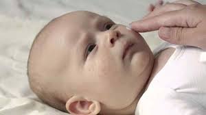 (fungal infection of the skin that causes brown or light colored spots on the chest, back, arms, legs, or neck), and yeast infections of the skin. How To Cure Baby Face Fungal How To Treat Fungus On Baby Skin