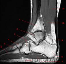 Explore more like foot muscle anatomy mri. Mri Of The Ankle Detailed Anatomy W Radiology