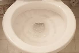 How To Treat Toilet Bowl Stains Hunker Toilet Bowl Stains Toilet Bowl How To Clean Rust