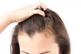 Maybe you would like to learn more about one of these? Rambut Rontok Bisa Jadi Tanda 7 Penyakit Ini