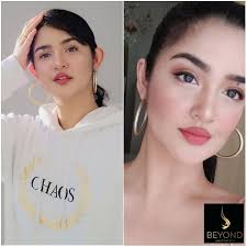 Our beautiful patient made even more beautiful with minimally invasive  OTOPLASTY (ear pinning). Achieving a more sophisticated look. "I'm so happy  with my new ears doc. The little change made a huge