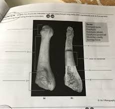 Cortex the shaft has a cortex (outer portion) of dense bony tissue called compact bone tissue. Solved Structures Indicated In A The Unsectioned Long B Chegg Com