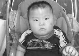 528 likes · 1 talking about this · 99 were here. A Case Of Pallister Killian Syndrome Associated With West Syndrome Pediatric Neurology